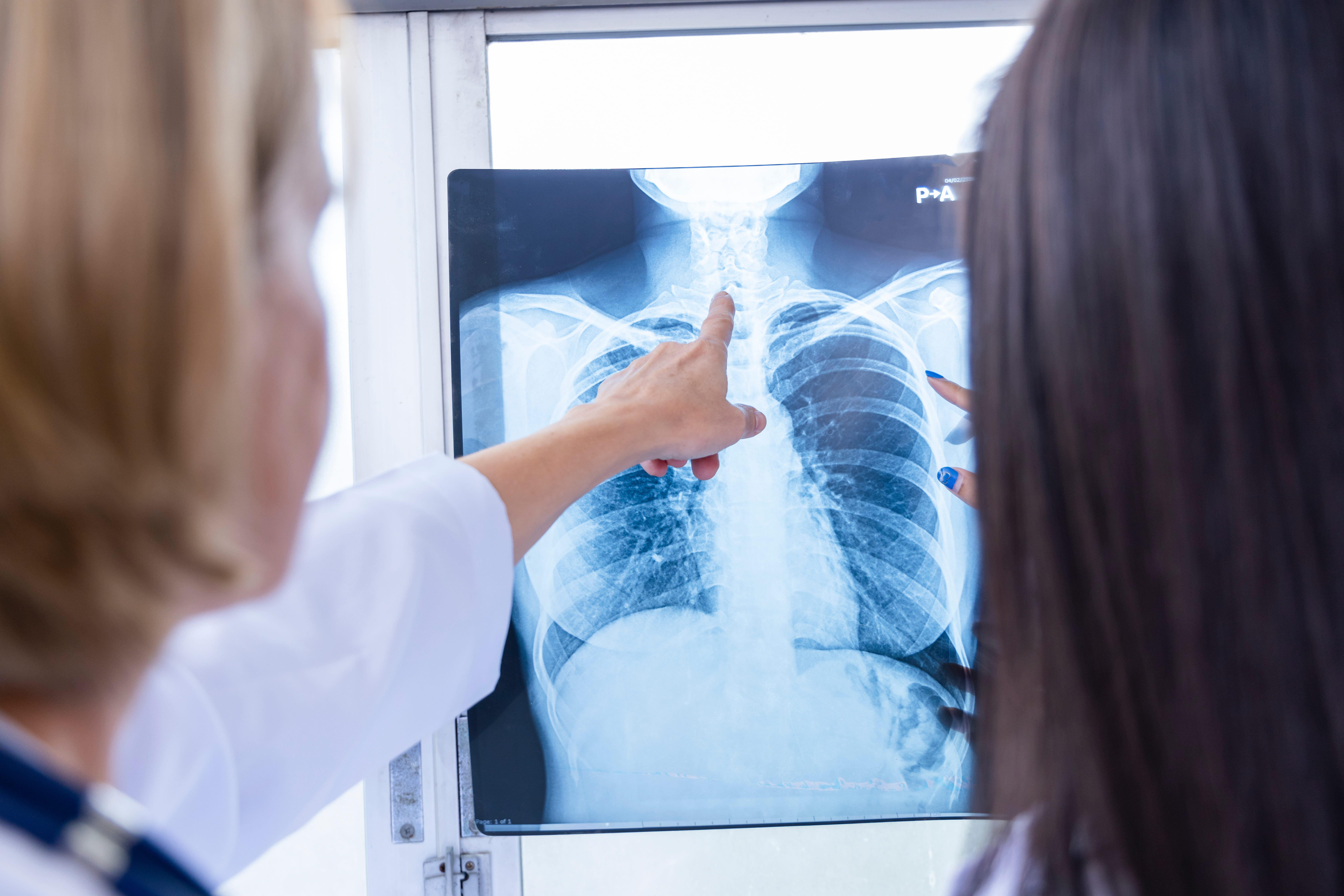 Cours sur l’interprétation des clichés de radiographie thoracique